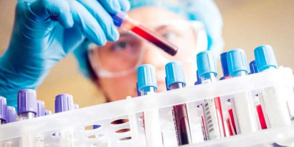 Clinical Laboratory Services Market Overview, Demand, Global Industry Share, Analysis and Growth 2028