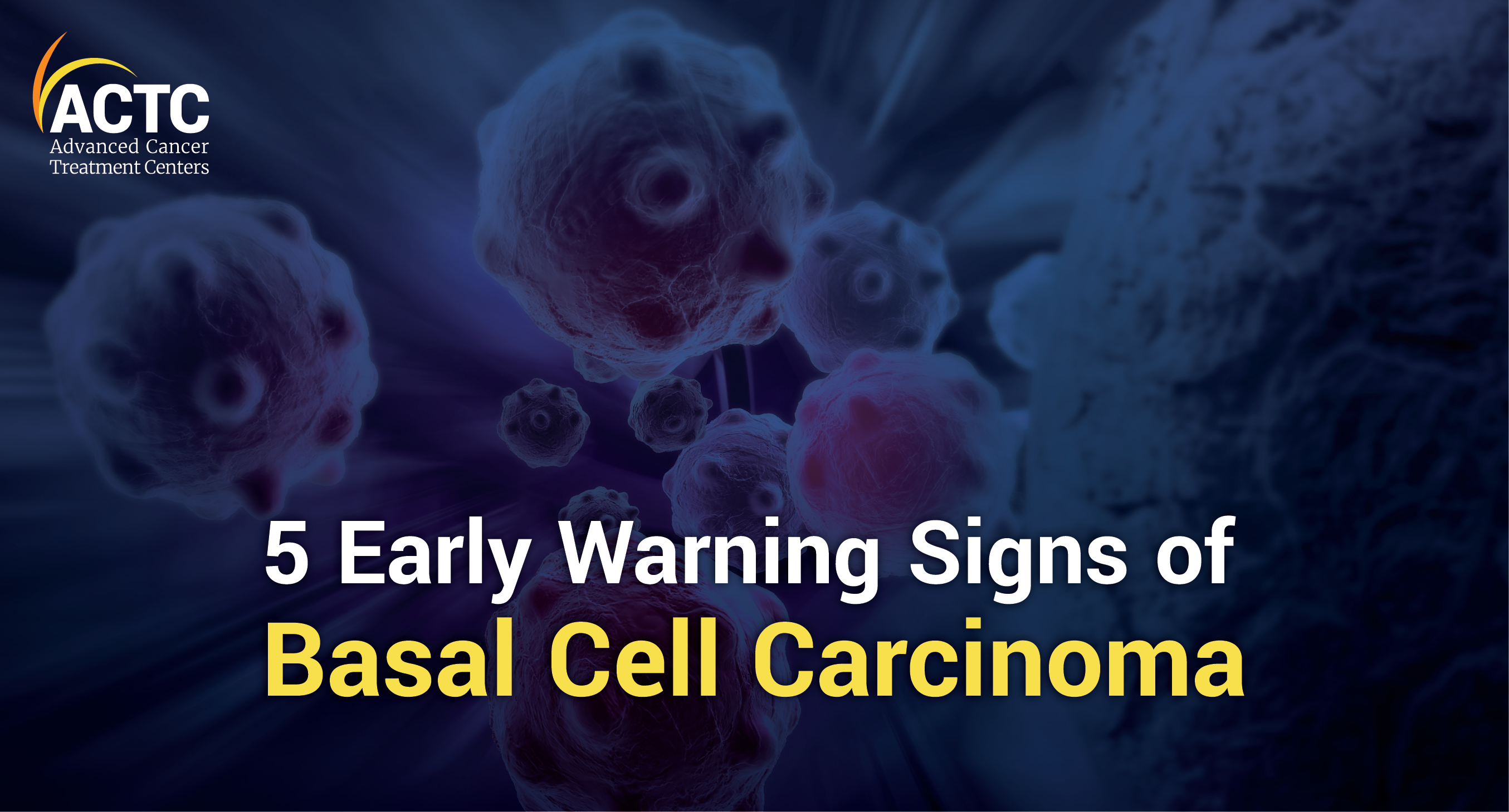 Early Warning Signs of Basal Cell Carcinoma | ACTC Blog