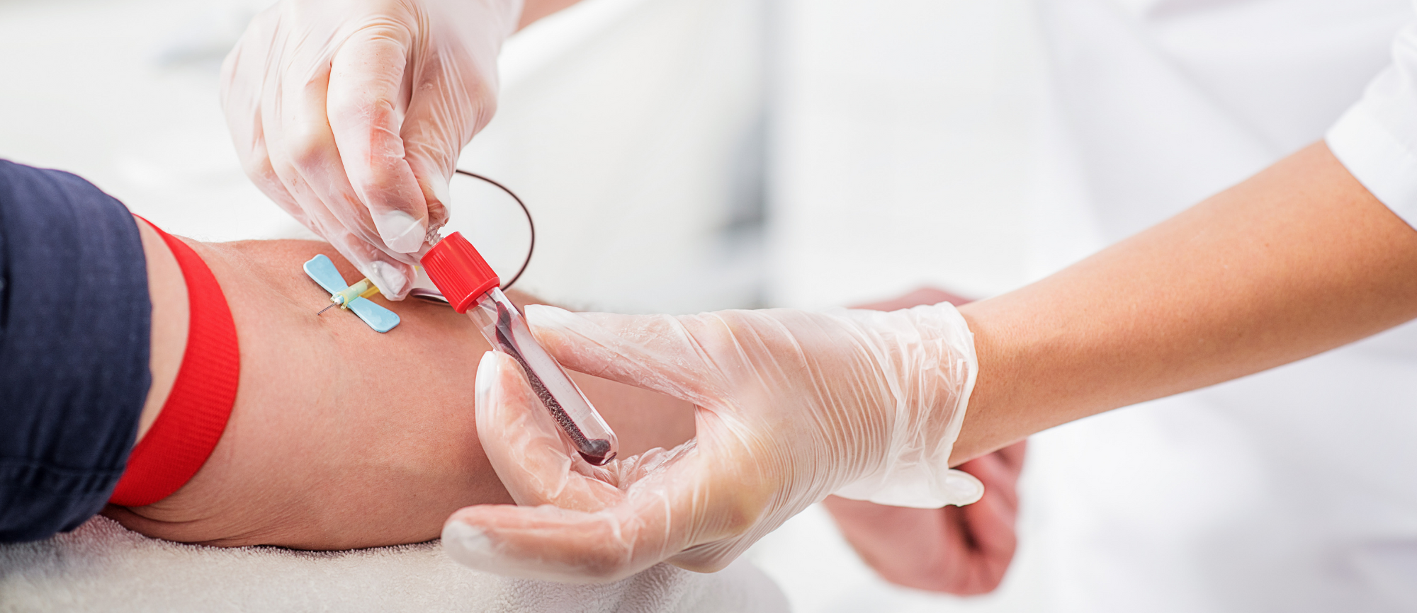 Essential Blood Testing in Longfield, Dartford & Gravesend