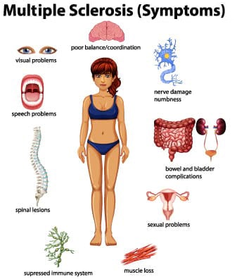 Recognizing Symptoms of MS in Women