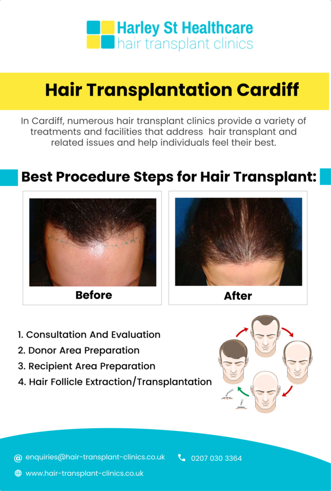 Hair Transplantation Cardiff