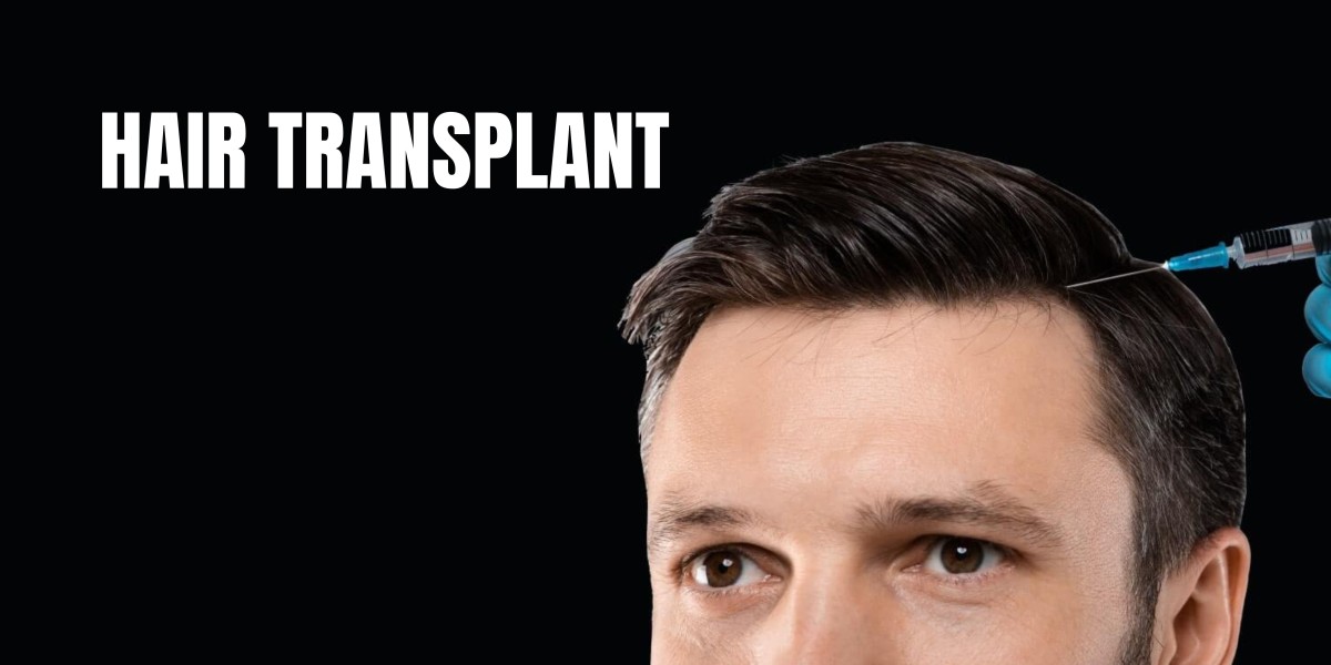 Can A Hair Transplant Make Your Forehead Smaller?