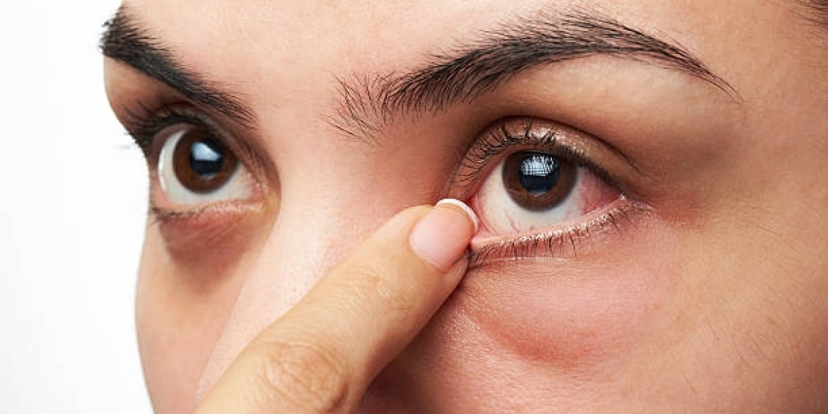 The Economics of Dry Eye Disease: Market Size and Revenue Forecast