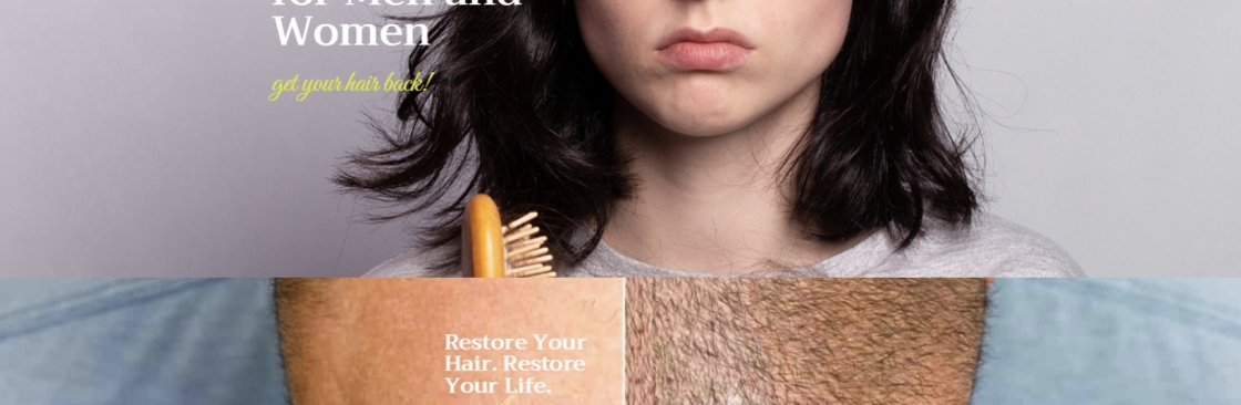 Capillus Hair Implantation Cover Image