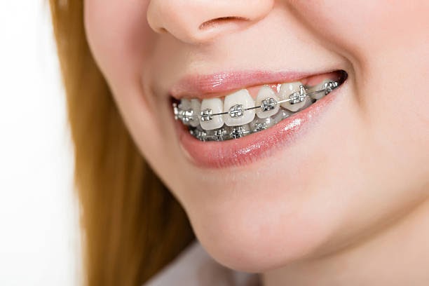 Questions to ask during your first visit to an orthodontics appointment