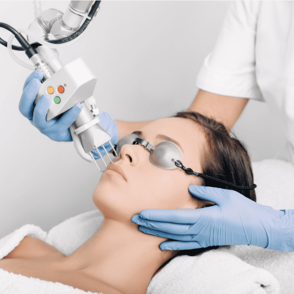 DEKA CO2 Laser Face Contouring Treatments | My Wellness Studio